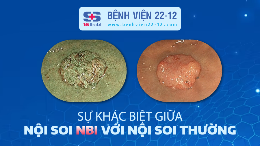 7. Các biến chứng có thể gặp khi nội soi NBI