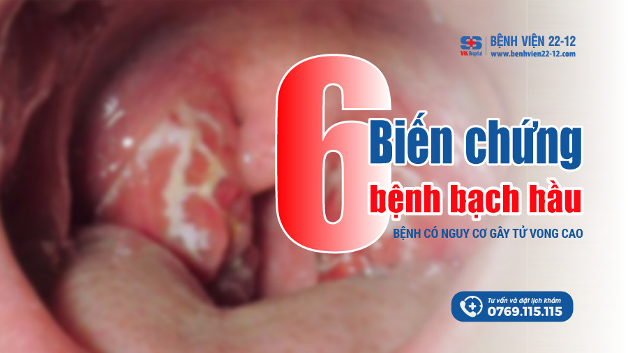 Benh vien 22-12 | Benh bach hau - Dau hieu va cac bien chung nguy hiem