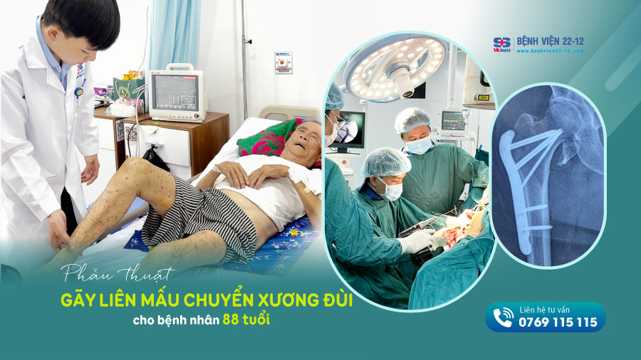 Bệnh viện 22-12 | Phẫu thuật thành công bệnh nhân 88 tuổi gãy liên mấu chuyển xương đùi