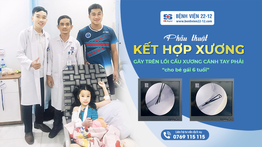 Bệnh viện 22-12 | Phẫu thuật kết hợp xương gãy trên lồi cầu xương cánh tay phải cho bé gái 6 tuổi