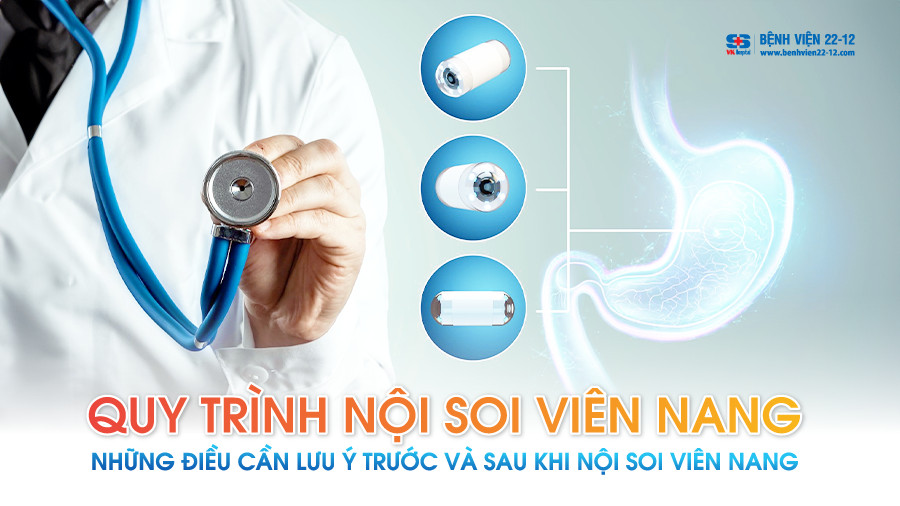 Quy trình nội soi viên nang - Bệnh viện 22-12 | VK Hospital | Bệnh viện ...