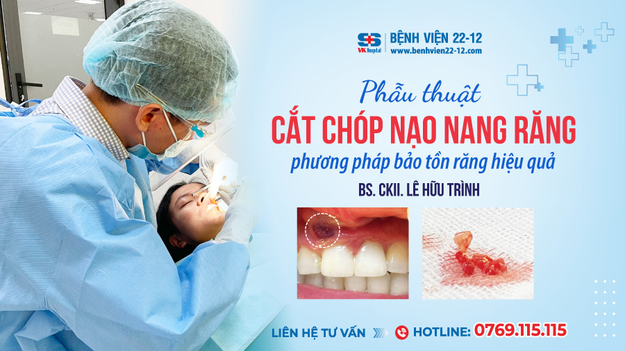 Bệnh viện 22-12 | Phẫu thuật cắt chóp nạo nang răng