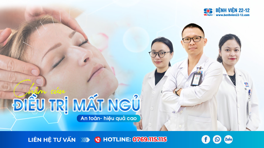 Bệnh viện 22-12 | Châm cứu điều trị mất ngủ