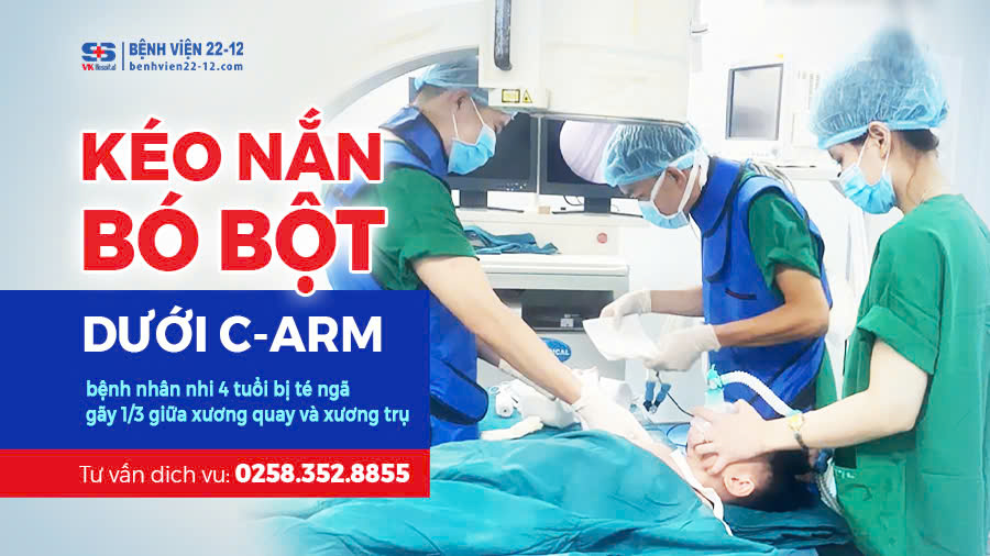 Bệnh viện 22-12 | Kéo nắn bó bột dưới màn hình tăng sáng  Thành công cho bệnh nhi gãy 1/3 giữa xương quay và xương trụ