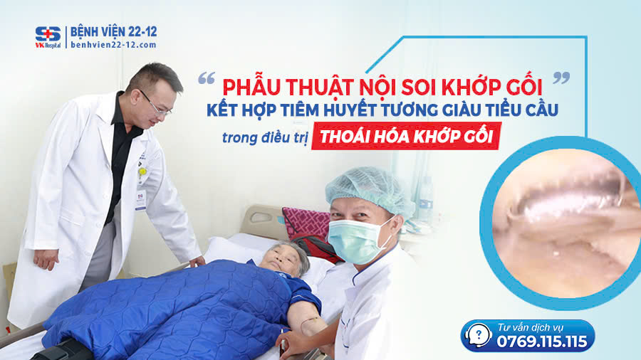 Bệnh viện 22-12 áp dụng phẫu thuật nội soi khớp gối kết hợp tiêm huyết tương giàu tiểu cầu trong điều trị thoái hóa khớp gối