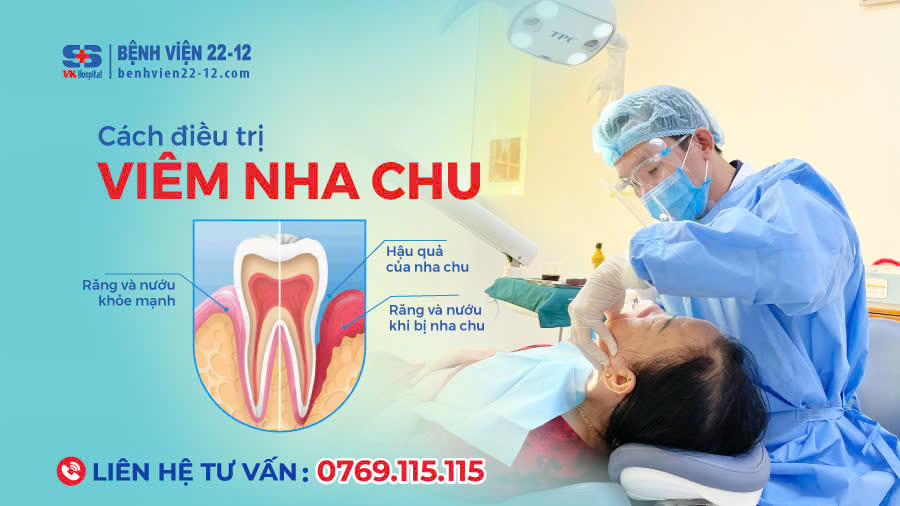 Bệnh viện 22-12 | Viêm nha chu và cách điều trị