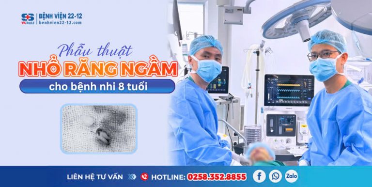 Phau-thuat-nho-rang-ngam