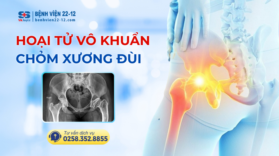Bệnh viện 22-12 | Hoại tử vô khuẩn chỏm xương đùi