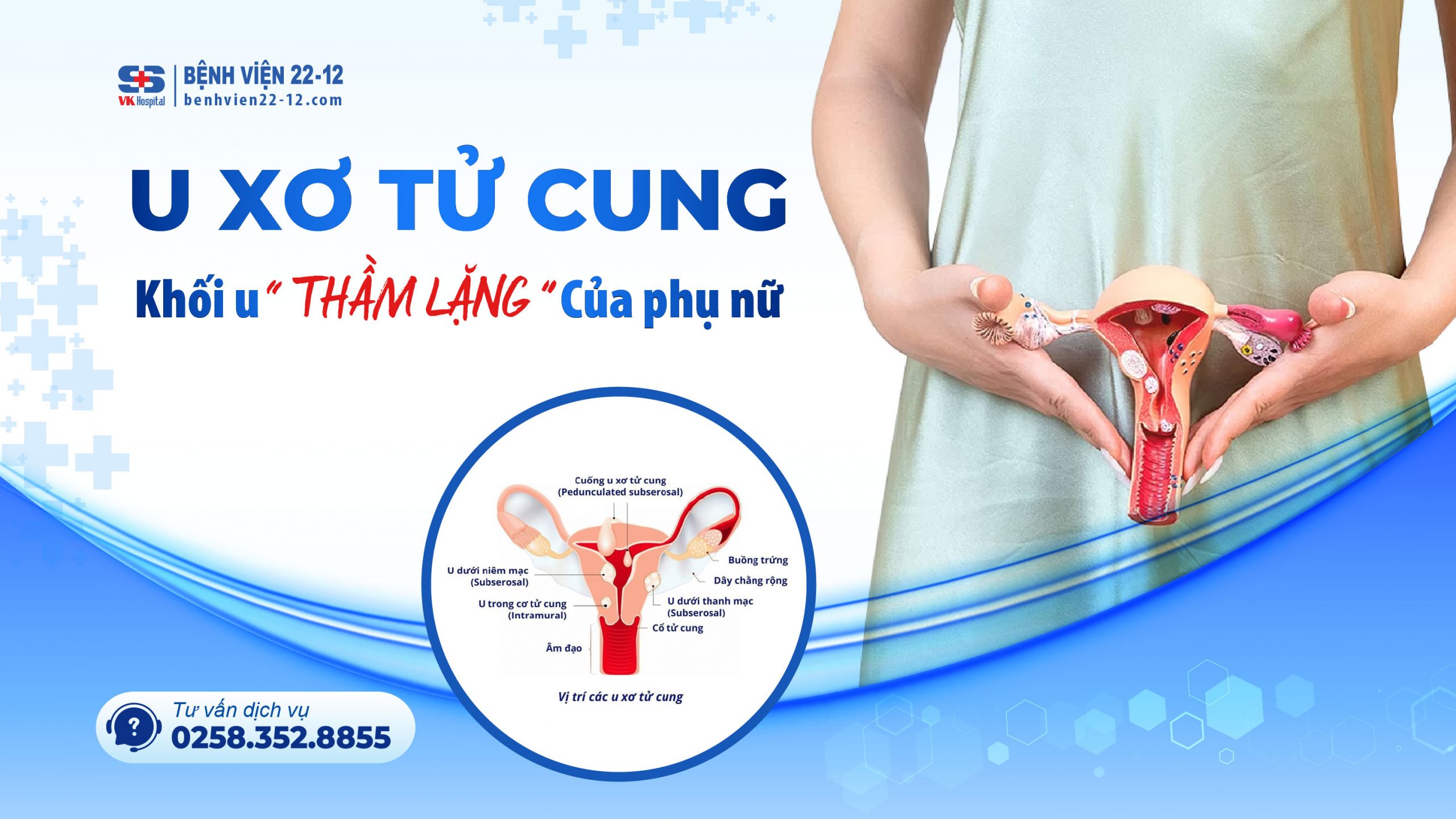 Bệnh viện 22-12 | U xơ tử cung Bệnh viện 22-12 | U xơ tử cung