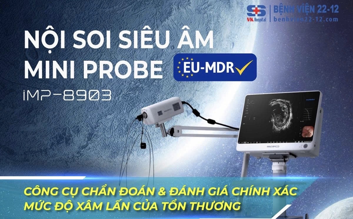 Bệnh viện 22-12 | Nội soi siêu âm mini probe