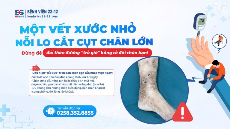 MOT-VET-THUONG-NHO-NOI-LO-CAT-CUT-CHAN