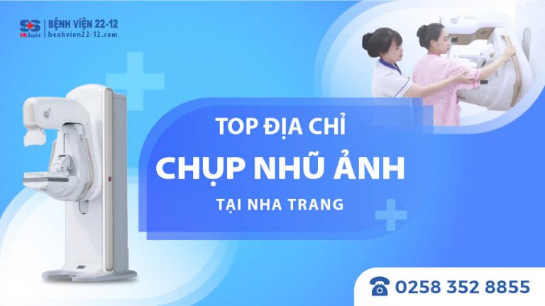 MAY-NHU-ANH