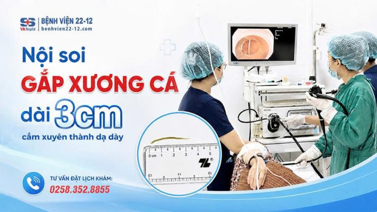 GAP-XUONG-CA