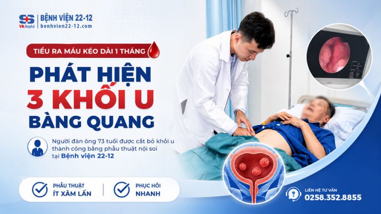 khoi-u-bang-quang-benhvien2212