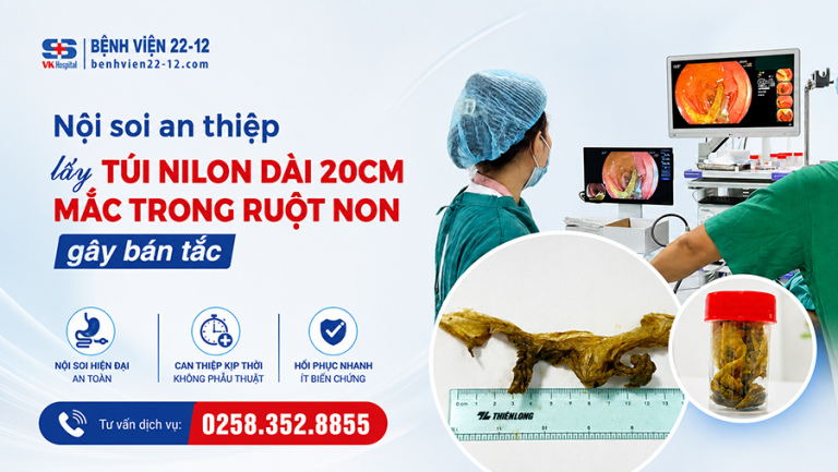 noi soi lay di vat