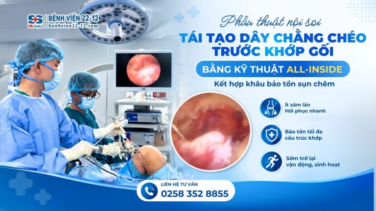 tai-tao-day-chang-cheo